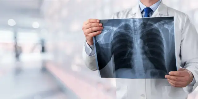 Skąd się bierze woda w płucach? Poznaj przyczyny i objawy obrzęku