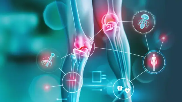 Zapalenie stawów: Pokazujemy 6 skutecznych terapii łagodzących ból
