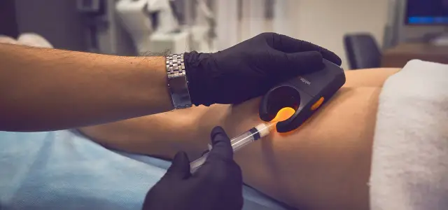 Lekarz w czarnej rękawiczce używa urządzenia do podświetlania żył podczas zabiegu skleroterapii. Poznaj skleroterapia cena.