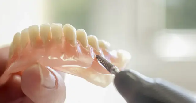 Dentyści dopracowują protezę acetalową, nadając jej idealny kształt.