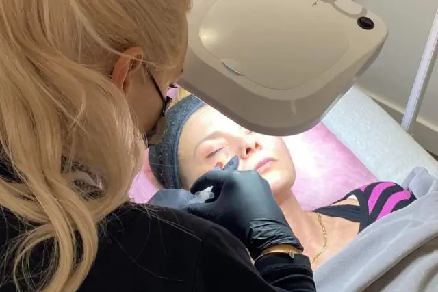 Zabieg z użyciem fibryny bogatopłytkowej. Kosmetolog aplikuje preparat pod oczy pacjentki.