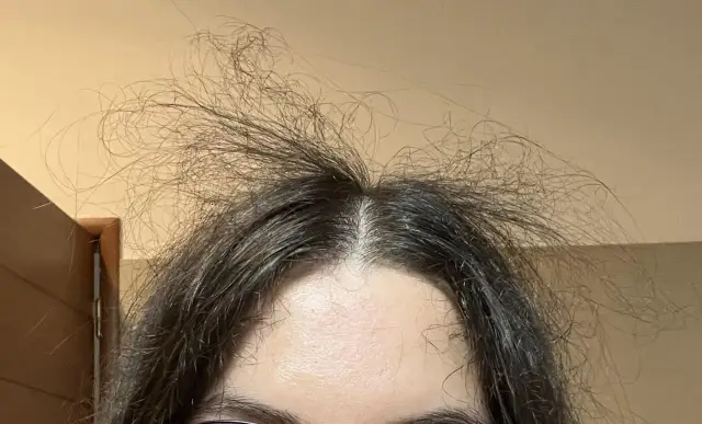 Rozwichrzone baby hair sterczą na czubku głowy, tworząc artystyczny nieład.
