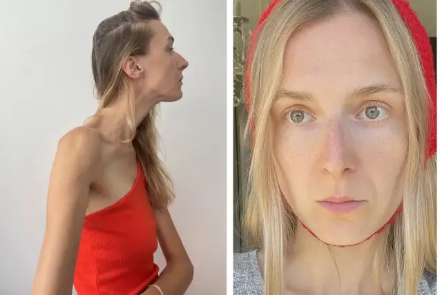 Dwie fotografie kobiety: z profilu w pomarańczowej bluzce i przodem, z czerwonym opaską na głowie. Naturalna uroda, make up no make up.