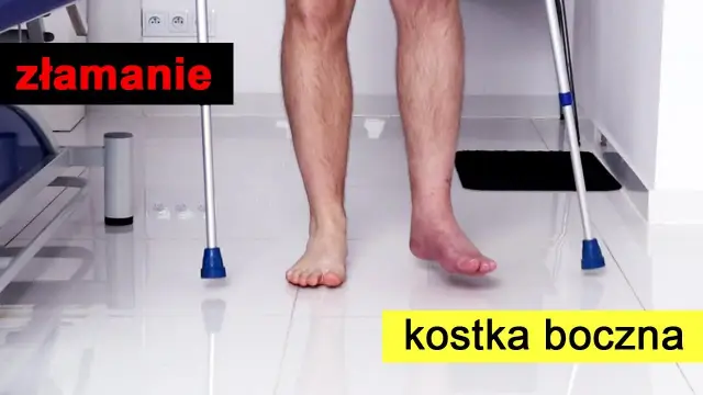 Jak ćwiczyć nogę po zdjęciu gipsu, aby uniknąć bólu i szybkiej rehabilitacji