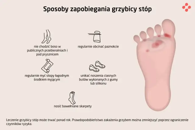 Ilustracja pokazuje stopę z objawami grzybicy, obok grafiki przedstawiające sposoby zapobiegania: unikanie chodzenia boso, dbanie o paznokcie, mycie stóp, noszenie luźnych butów i bawełnianych skarpet.