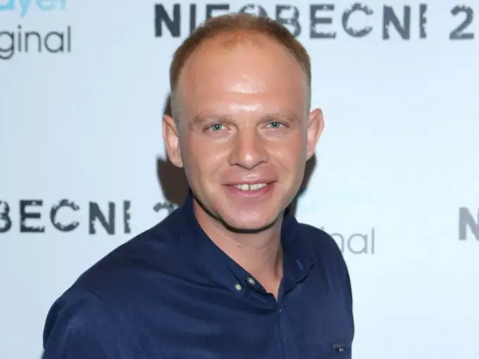 Kazimierz Mazur: Przeszczep włosów i metamorfoza co musisz wiedzieć?