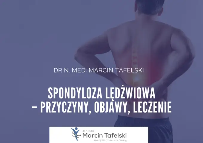 Spondyloza - Ból kręgosłupa? Jak sobie pomóc i co leczy
