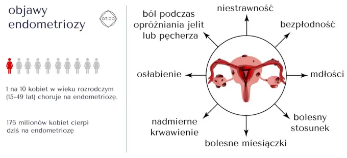 Endovelle - na endometriozę, nie antykoncepcję? Poznaj fakty!
