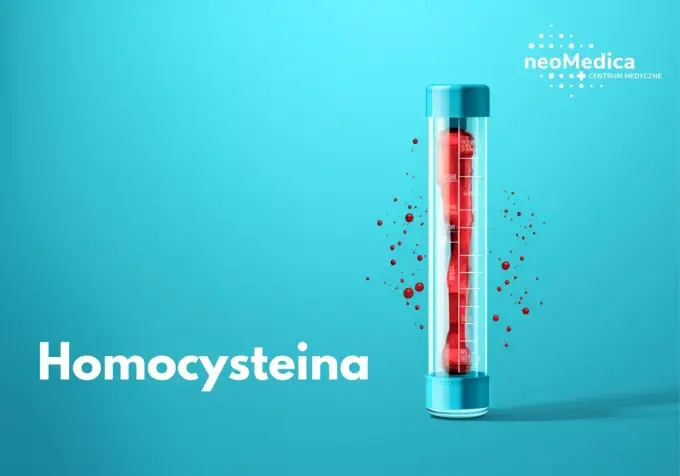 Homocysteina - Co oznacza wysoki poziom? Sprawdź!