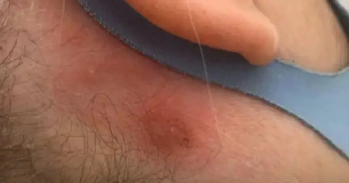 Alergia na farbę do włosów? Jak rozpoznać i skutecznie sobie radzić