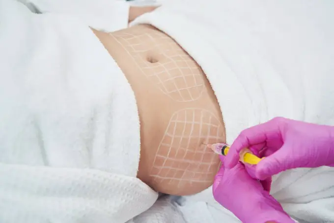 Lipoliza iniekcyjna - Sprawdź ceny za podbródek, brzuch i serię