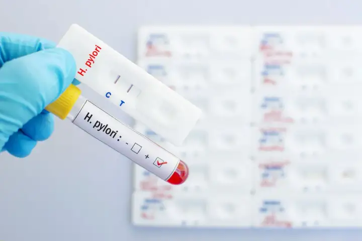 H. pylori - Jakie badanie wybrać? Poradnik krok po kroku