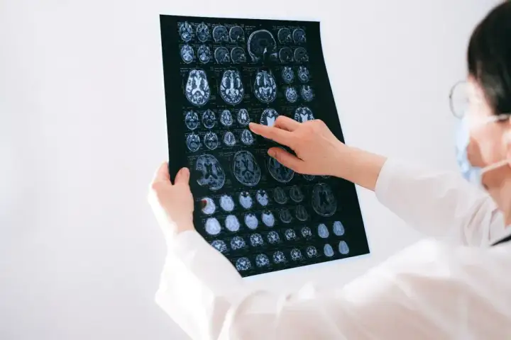 Zarobki neurologa w Polsce: mediana, widełki i kluczowe czynniki
