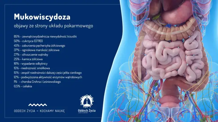 Mukowiscydoza - objawy, diagnostyka i co powinno zaniepokoić?
