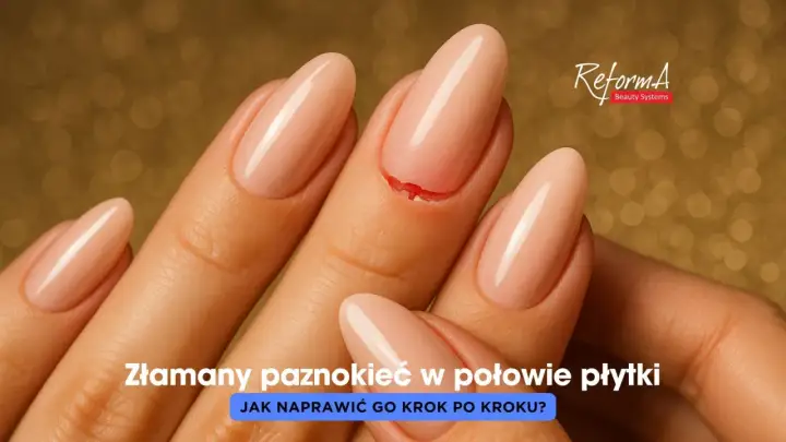 Złamany paznokieć w połowie płytki, który wymaga natychmiastowej naprawy.