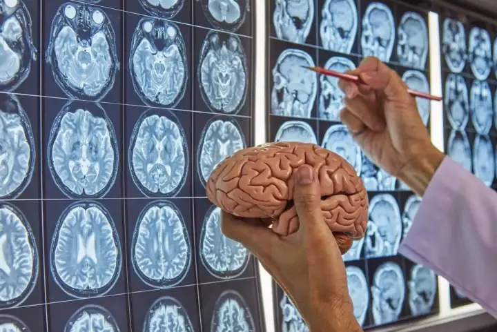 Chirurg neurolog analizuje przekroje mózgu na obrazach MRI, trzymając model ludzkiego mózgu.