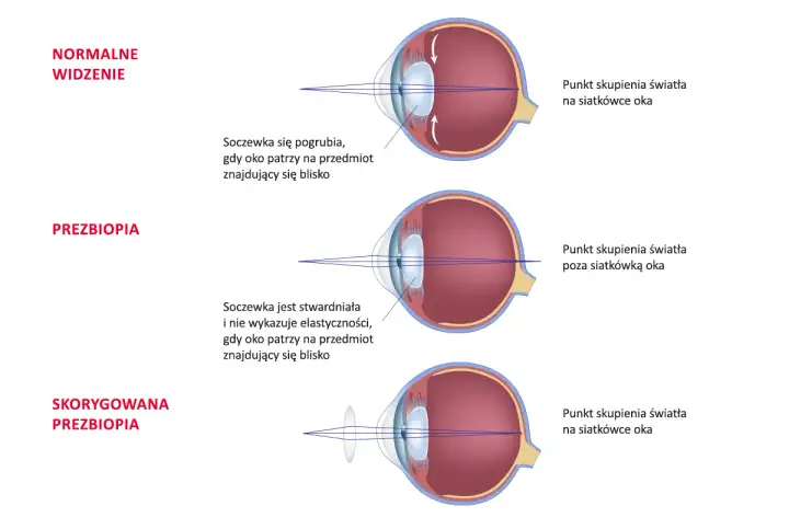 Nie widzisz z bliska? Jakie okulary wybrać na prezbiopię?