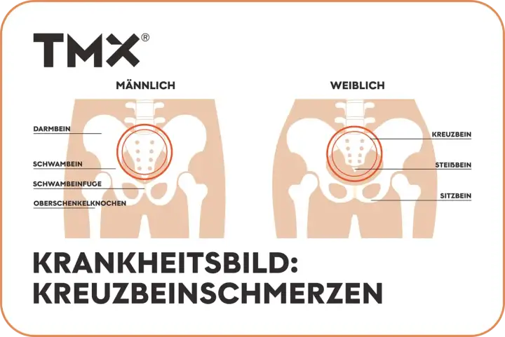 Vergleich männliches und weibliches Becken mit Hervorhebung des os sacrum. Illustration von Kreuzbeinschmerzen.