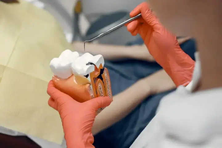 Model zęba pokazuje, co to endodoncja: leczenie kanałowe. Dentysta w rękawiczkach pokazuje uszkodzony ząb.