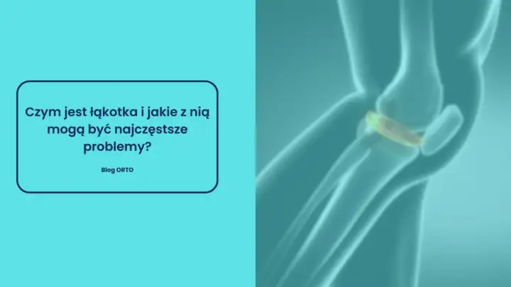 Ilustracja anatomiczna stawu kolanowego z widoczną łąkotką.