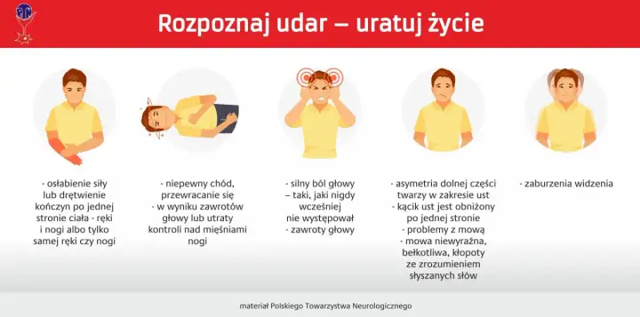 Objawy udaru mózgu: osłabienie kończyn, zaburzenia mowy, bóle głowy, problemy z widzeniem. Pierwsza pomoc jest kluczowa.