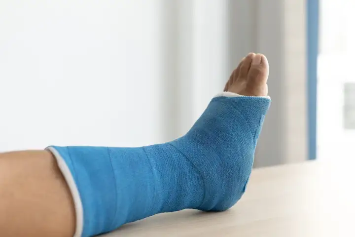Złamanie trójkostkowe - Leczenie, rehabilitacja i powrót do formy