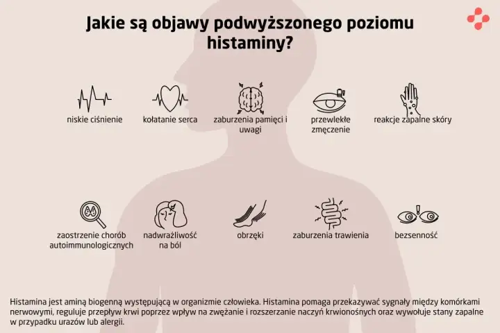 Objawy nietolerancji histaminy: Poznaj przyczyny i skuteczne leczenie