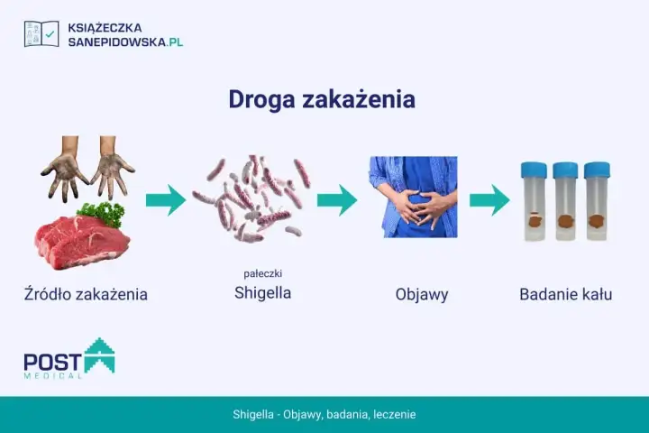 Droga zakażenia czerwonką: brudne ręce i surowe mięso prowadzą do pałeczek Shigella, objawów bólu brzucha i badań kału.