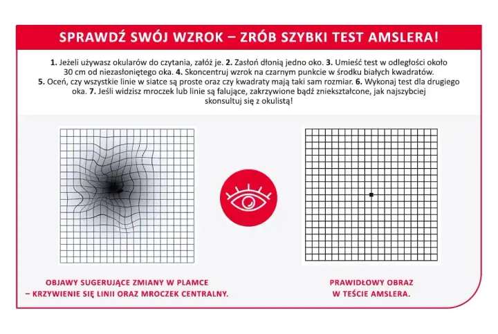 Falowanie obrazu w oku może być objawem zmian w plamce. Test Amslera pokazuje zniekształcone linie, sugerując problemy ze wzrokiem.