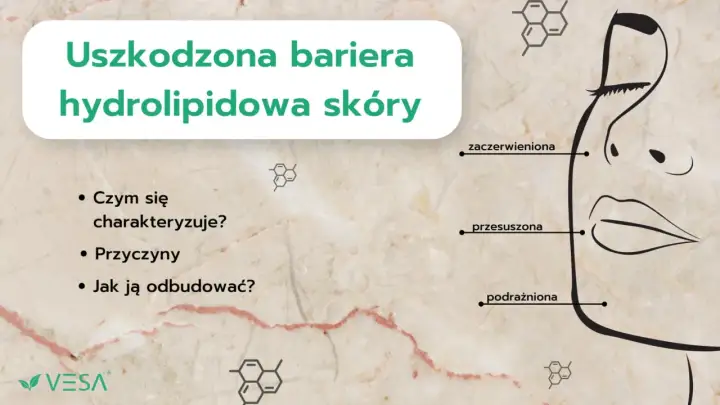 Uszkodzona bariera hydrolipidowa skóry objawia się zaczerwienieniem, przesuszeniem i podrażnieniem. Dowiedz się, jak ją odbudować.