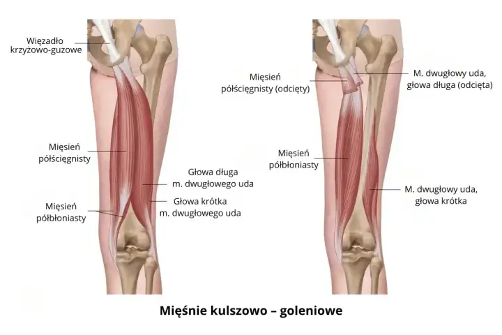 Anatomia mięśni kulszowo-goleniowych, które mogą powodować ból mięśni. Widoczne więzadło krzyżowo-guzowe i mięśnie: półścięgnisty i półbłoniasty.