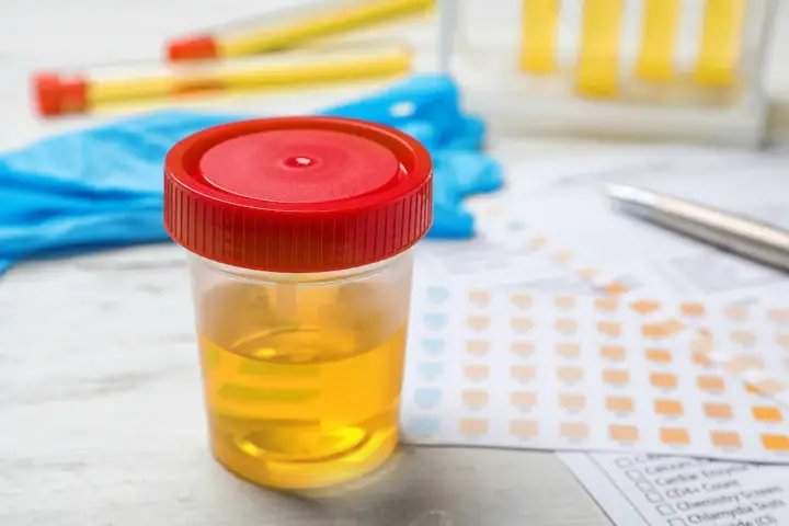 Pojemnik z moczem, rękawiczki, paski testowe i formularz z wynikami. Wynik: posiew moczu ujemny.