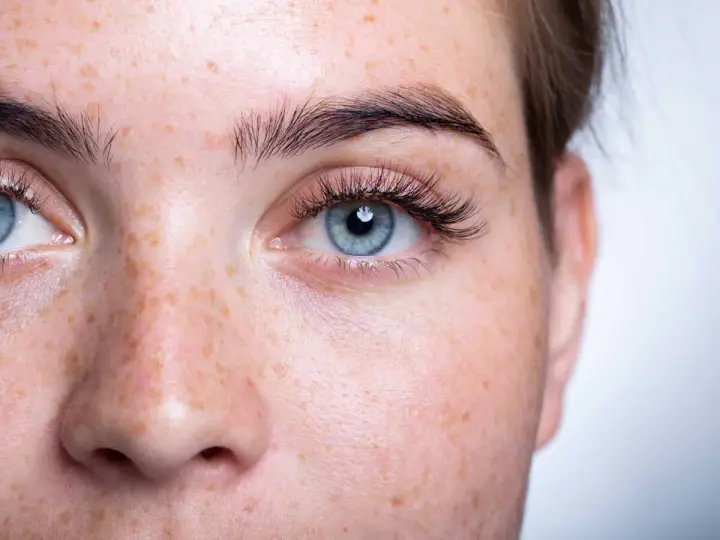 Gros plan sur un visage de femme aux yeux bleus et à la peau tachetée de rousseur. Ses cils courts et peu fournis encadrent un regard intense.