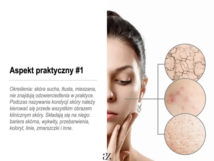 Kobieta z problemami skórnymi: sucha, popękana, z wypryskami i rozszerzonymi porami. To mogą być zaburzenia hormonalne objawy.