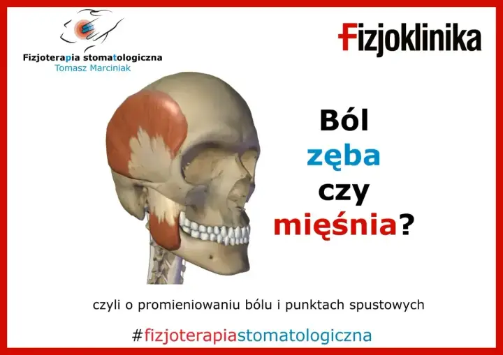 Anatomia czaszki z zaznaczonymi mięśniami. Czy to ból zęba czy mięśnia? Fizjoterapia stomatologiczna.