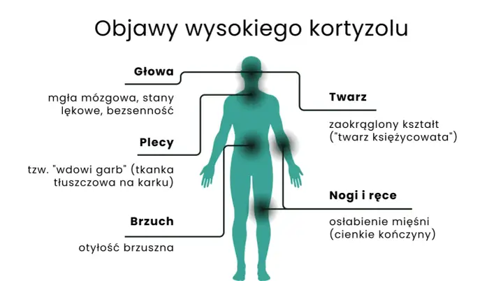 Objawy wysokiego kortyzolu: mgła mózgowa, otyłość brzuszna, "wdowi garb", zaokrąglona twarz, osłabienie mięśni.