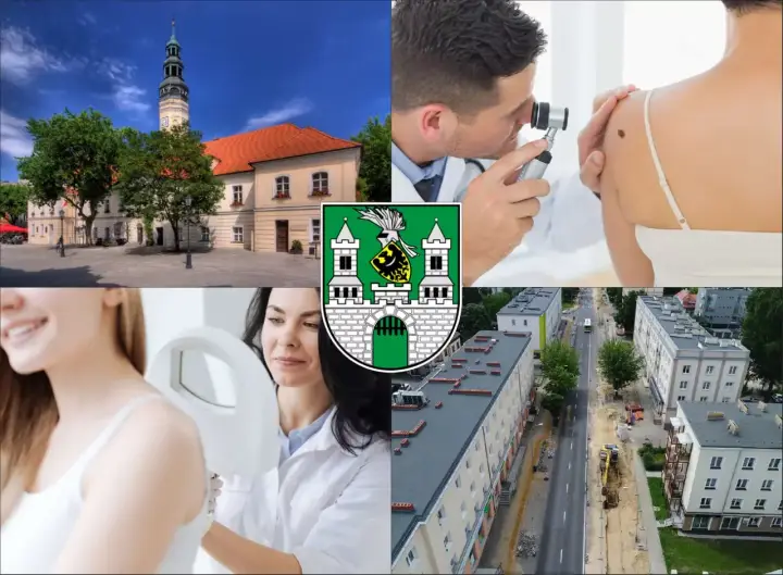 Kolaż: ratusz, lekarz badający znamię, herb miasta, pacjentka i widok ulicy.
