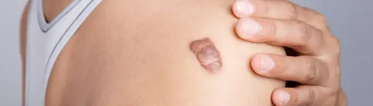 Jak się pisze skóra? Uniknij powszechnych błędów w pisowni