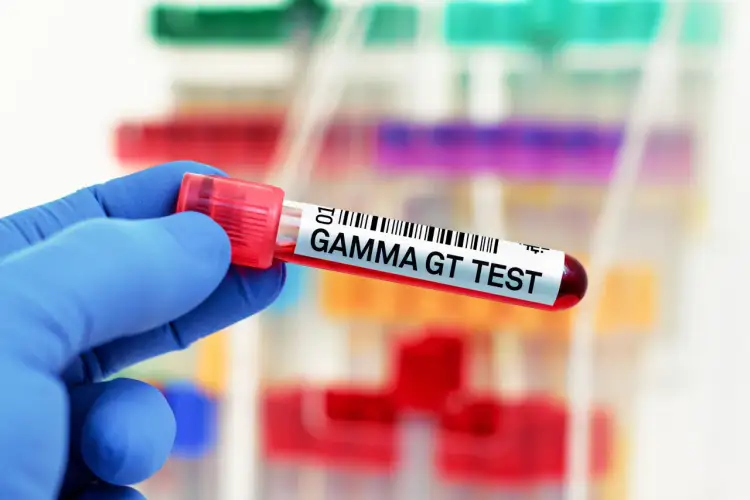 Ręka w niebieskiej rękawiczce trzyma probówkę z krwią oznaczoną "GAMMA GT TEST". To badanie ocenia poziom enzymu gamma-glutamylotranspeptydazy.