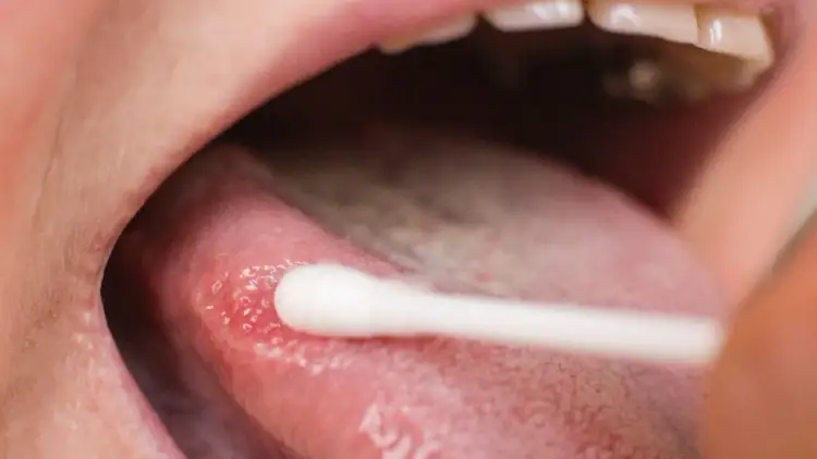 Do jakiego lekarza z językiem? Objawy, które wymagają wizyty