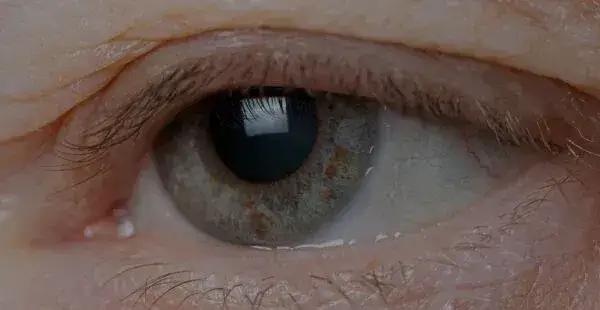 Blefaroplastyka a widzenie – czy zabieg poprawia pole widzenia?