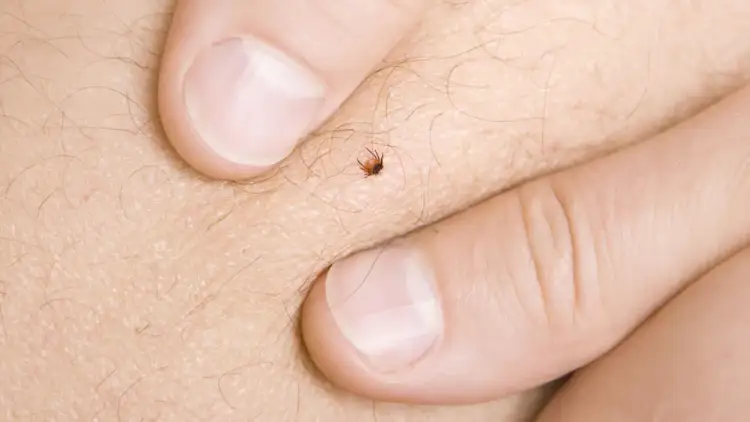 Jak bezpiecznie usunąć kleszcza bez pęsety – skuteczne metody i błędy, których unikać