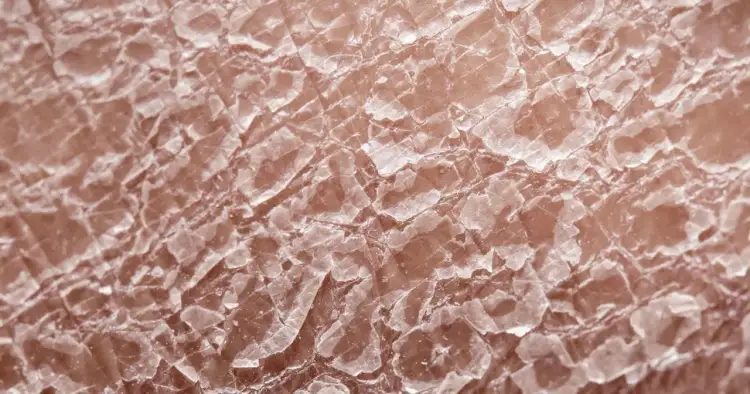 Metotreksat: Skutki uboczne? Poznaj prawdę i chroń swoje zdrowie