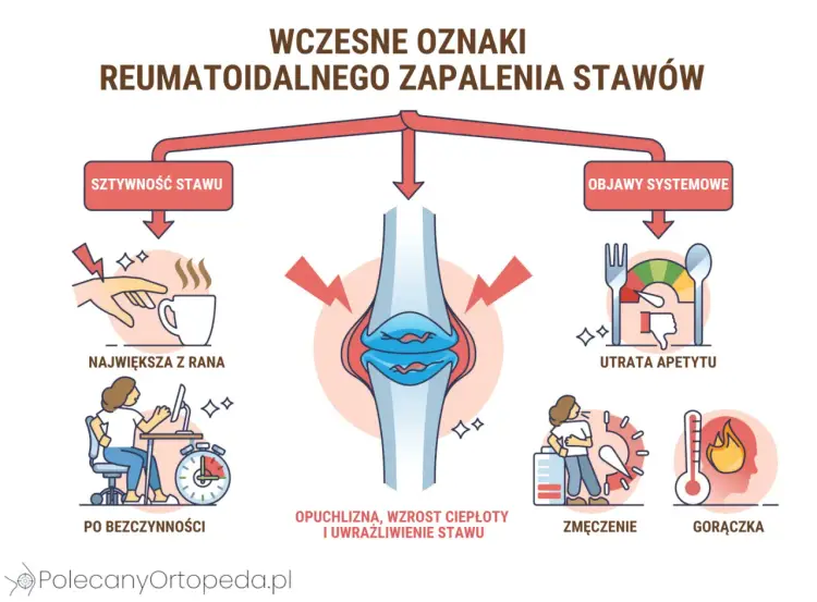 RF w badaniu krwi - Co oznacza i kiedy wskazuje na RZS?
