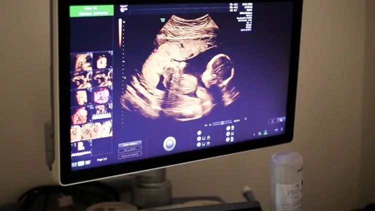 Jak się robi badania prenatalne? Poznaj metody i ich bezpieczeństwo