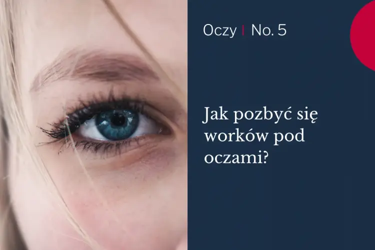 Worki pod oczami - Jak wybrać skuteczny zabieg? Poradnik