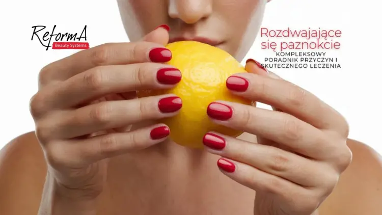 Pękające paznokcie - Przyczyny i skuteczne rozwiązania