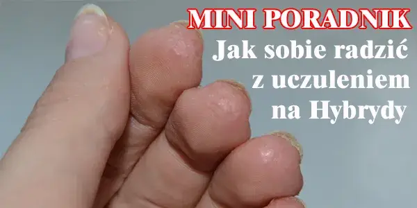 Uczulenie na hybrydę - jak rozpoznać objawy i co robić?