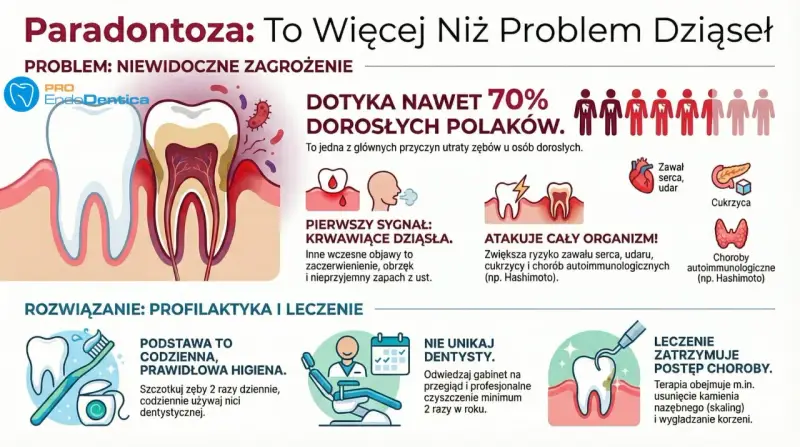 Ilustracja przedstawia przekrój zęba z widocznymi problemami dziąseł, bakterie i objawy paradontozy.