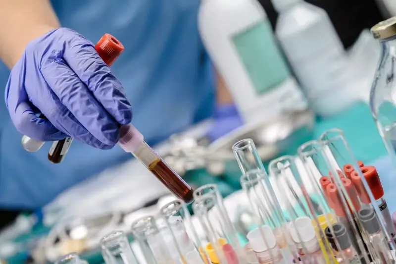 Ręka w niebieskiej rękawiczce trzyma probówkę z ciemnym płynem, prawdopodobnie badanie bilirubina całkowita. W tle inne probówki i butelki laboratoryjne.